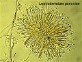 Lophodermium paeoniae-amf2072-asques et paraphyses